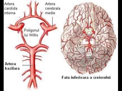 accidentul vascular cerebral